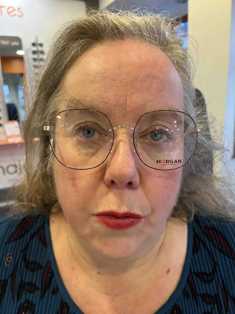 Opticiennes sur la commune de Tinténiac, dans le département de l'Ille-et Vilaine (28webp